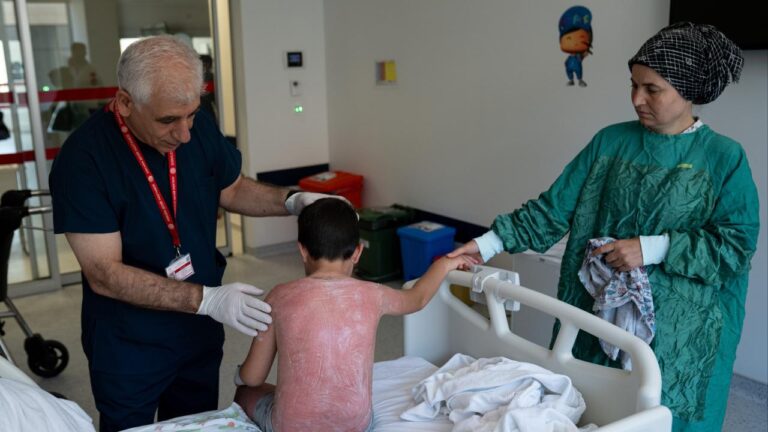 Çocuk Güneşte 4 Saat Kaldı, İkinci Derece Yanık Oldu