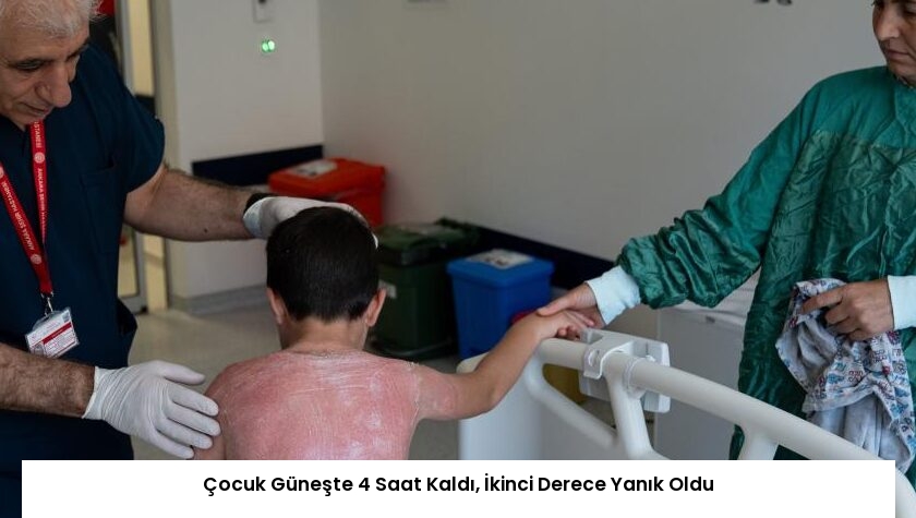 Çocuk Güneşte 4 Saat Kaldı, İkinci Derece Yanık Oldu