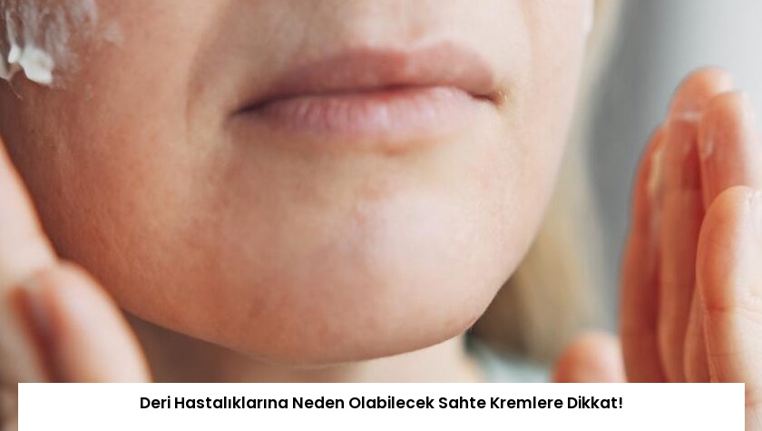Deri Hastalıklarına Neden Olabilecek Sahte Kremlere Dikkat!