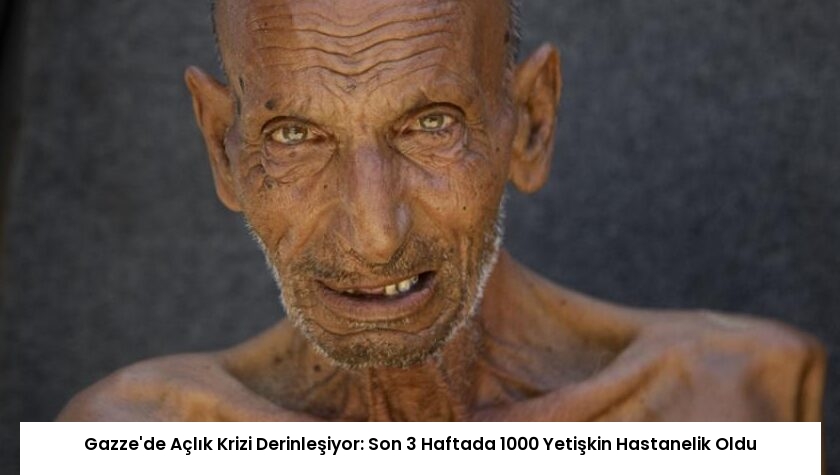 Gazze’de Açlık Krizi Derinleşiyor: Son 3 Haftada 1000 Yetişkin Hastanelik Oldu