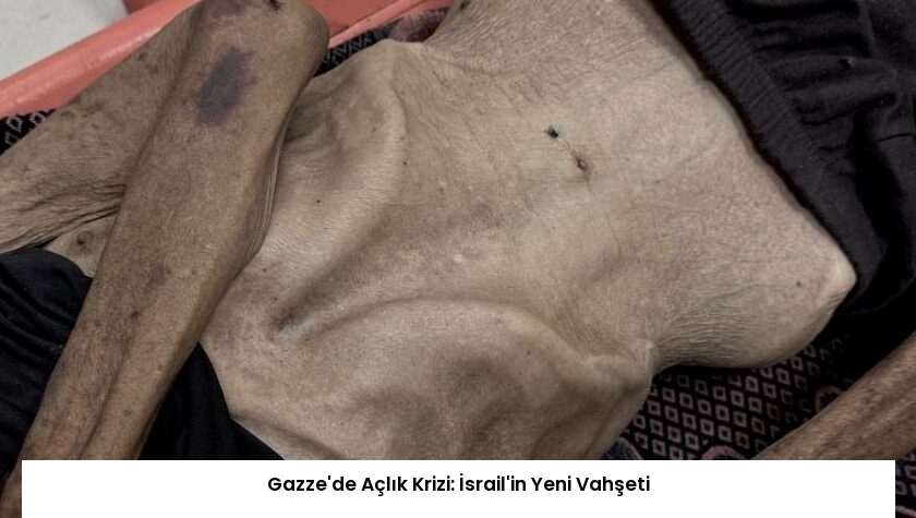 Gazze’de Açlık Krizi: İsrail’in Yeni Vahşeti