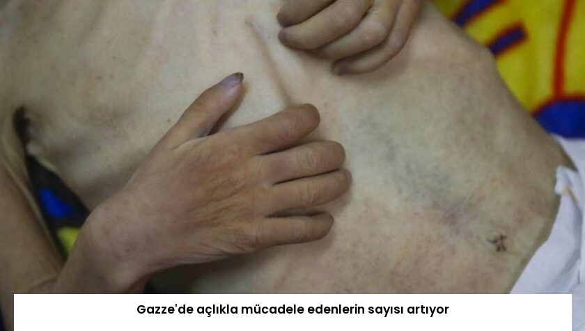 Gazze’de açlıkla mücadele edenlerin sayısı artıyor