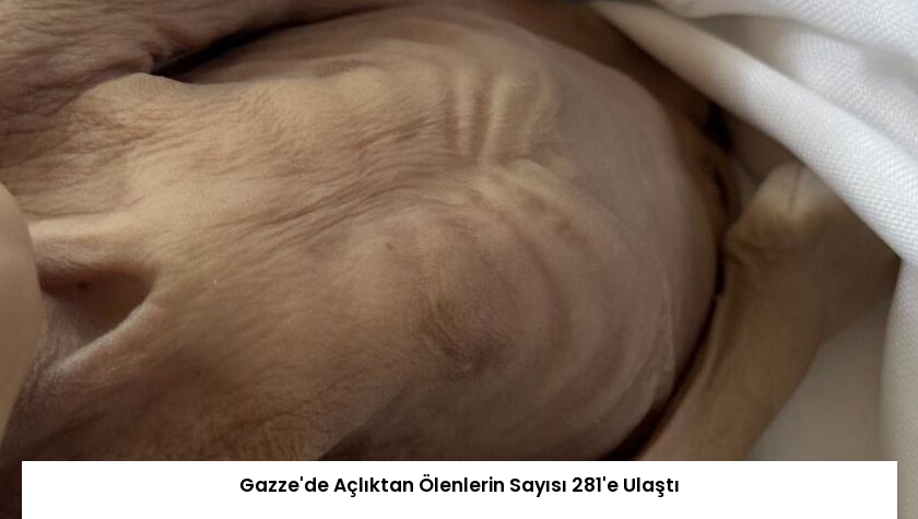 Gazze’de Açlıktan Ölenlerin Sayısı 281’e Ulaştı