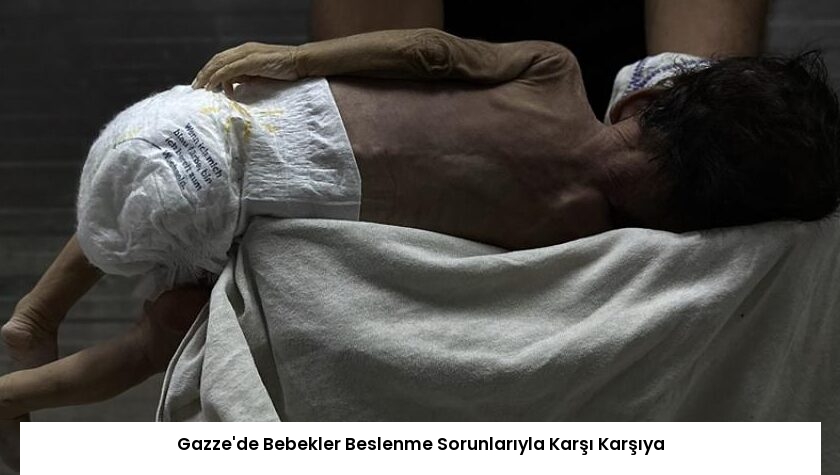 Gazze’de Bebekler Beslenme Sorunlarıyla Karşı Karşıya
