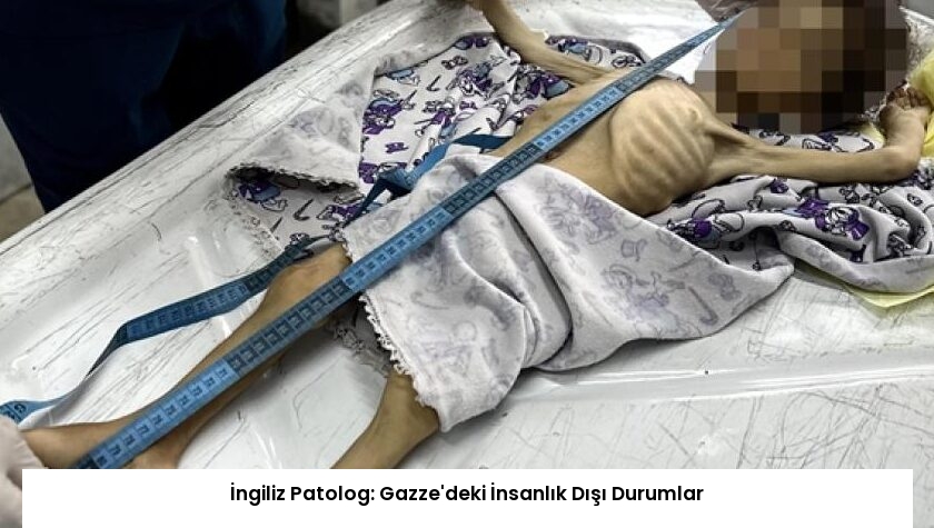 İngiliz Patolog: Gazze’deki İnsanlık Dışı Durumlar