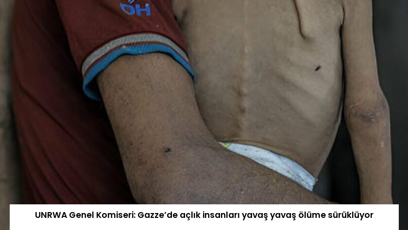 UNRWA Genel Komiseri: Gazze’de açlık insanları yavaş yavaş ölüme sürüklüyor