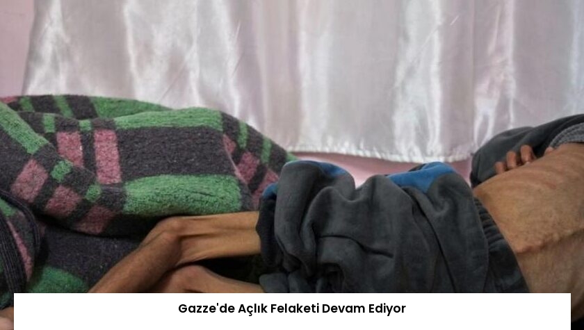 Gazze’de Açlık Felaketi Devam Ediyor