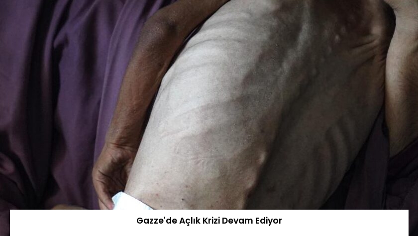 Gazze’de Açlık Krizi Devam Ediyor