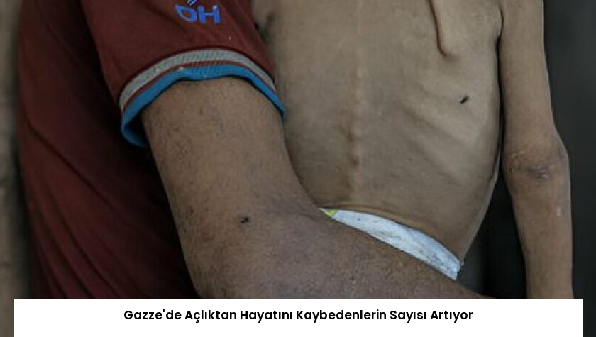 Gazze’de Açlıktan Hayatını Kaybedenlerin Sayısı Artıyor