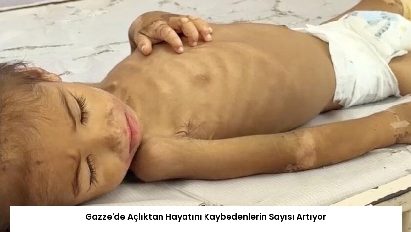 Gazze’de Açlıktan Hayatını Kaybedenlerin Sayısı Artıyor