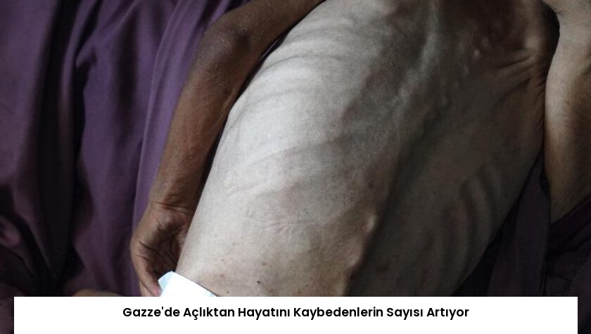 Gazze’de Açlıktan Hayatını Kaybedenlerin Sayısı Artıyor