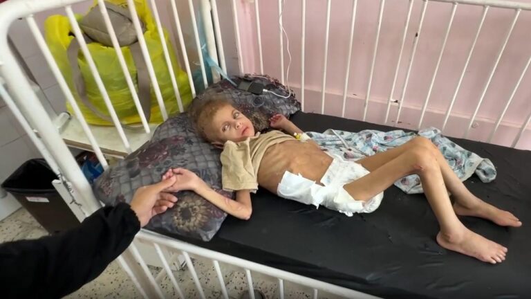 Gazze’de açlıktan yürüyemeyen 7 yaşındaki May