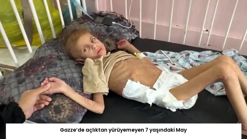 Gazze’de açlıktan yürüyemeyen 7 yaşındaki May