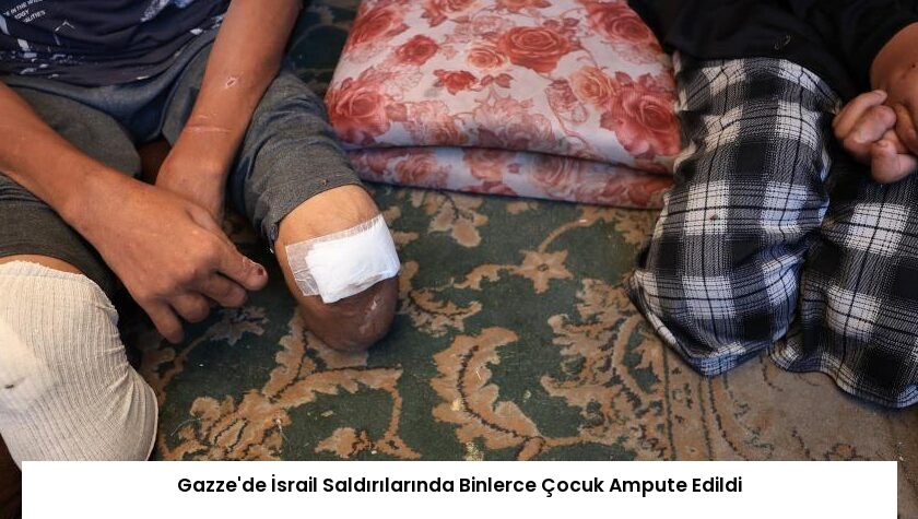 Gazze’de İsrail Saldırılarında Binlerce Çocuk Ampute Edildi