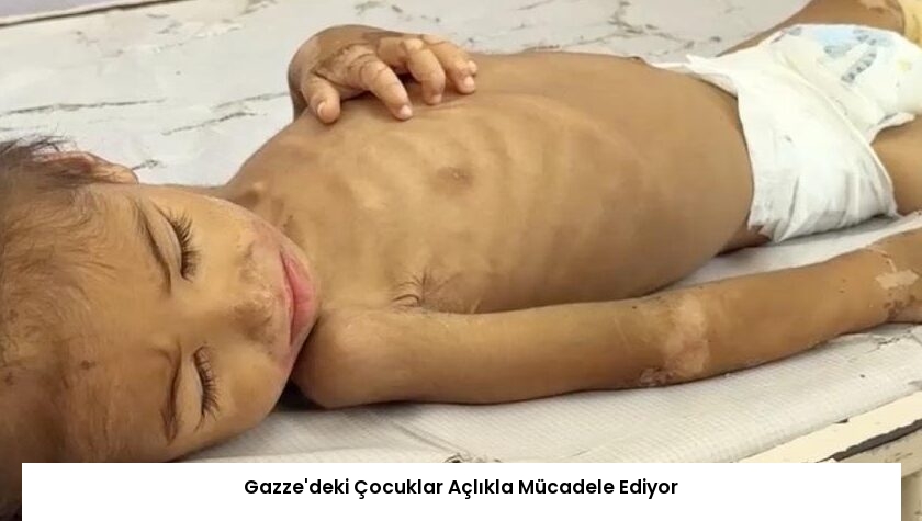 Gazze’deki Çocuklar Açlıkla Mücadele Ediyor