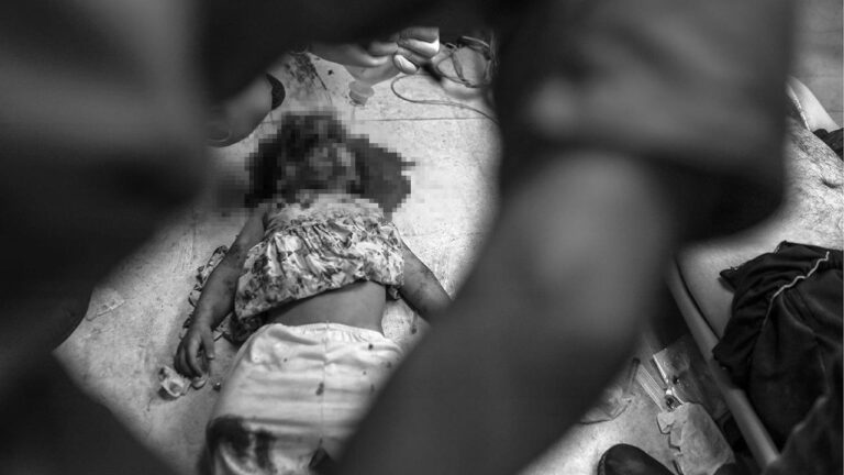 Gazze’deki hastaneler İsrail saldırılarıyla çöküyor: Doktorlar ameliyatları anestezisiz yapıyor