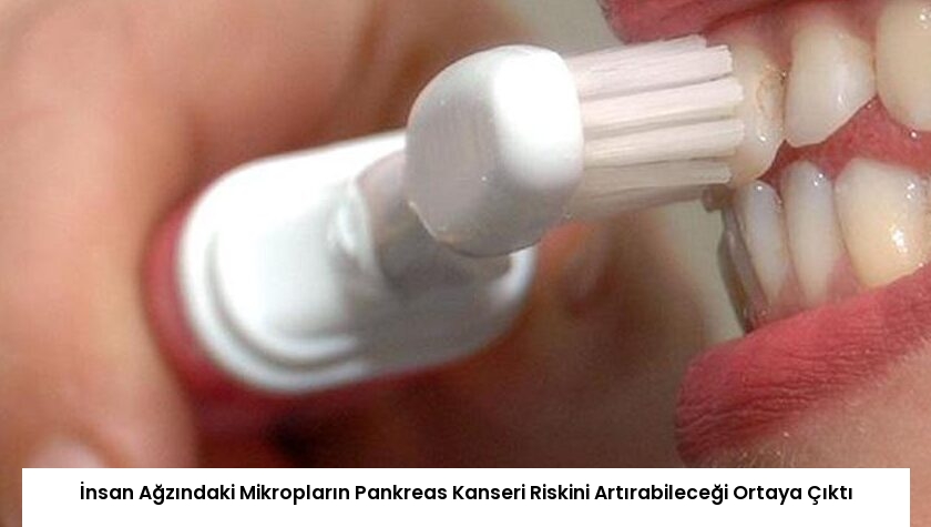İnsan Ağzındaki Mikropların Pankreas Kanseri Riskini Artırabileceği Ortaya Çıktı
