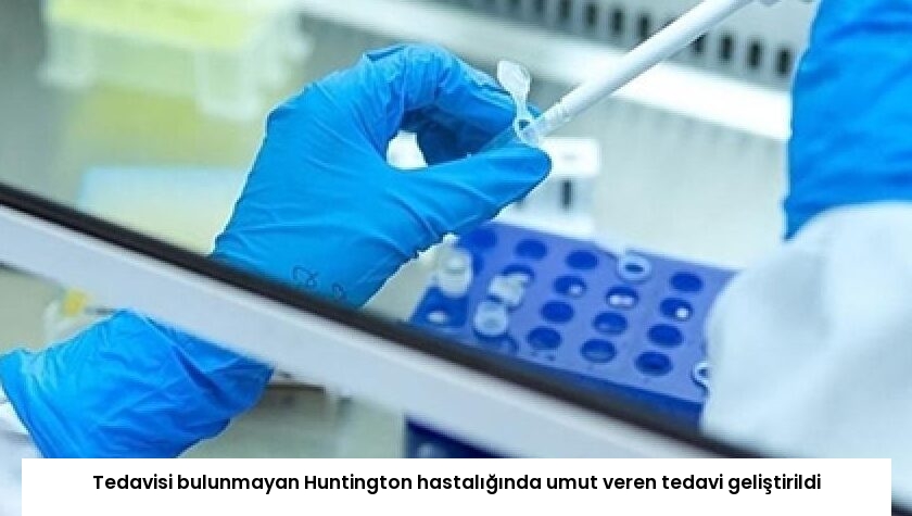 Tedavisi bulunmayan Huntington hastalığında umut veren tedavi geliştirildi