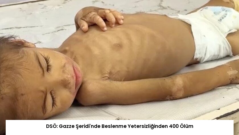 DSÖ: Gazze Şeridi’nde Beslenme Yetersizliğinden 400 Ölüm