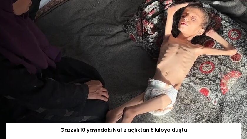 Gazzeli 10 yaşındaki Nafız açlıktan 8 kiloya düştü
