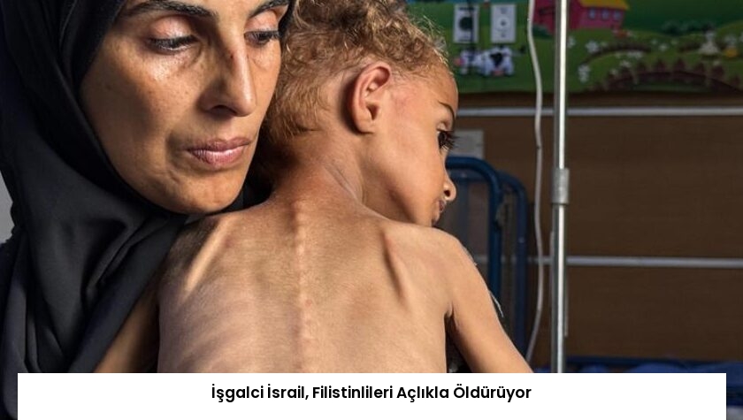 İşgalci İsrail, Filistinlileri Açlıkla Öldürüyor