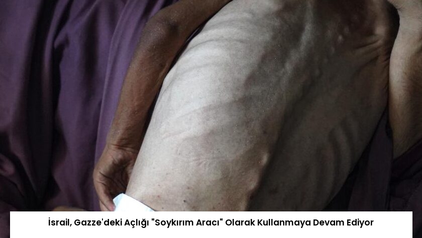 İsrail, Gazze’deki Açlığı “Soykırım Aracı” Olarak Kullanmaya Devam Ediyor