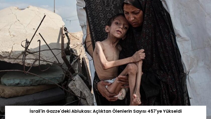 İsrail’in Gazze’deki Ablukası: Açlıktan Ölenlerin Sayısı 457’ye Yükseldi