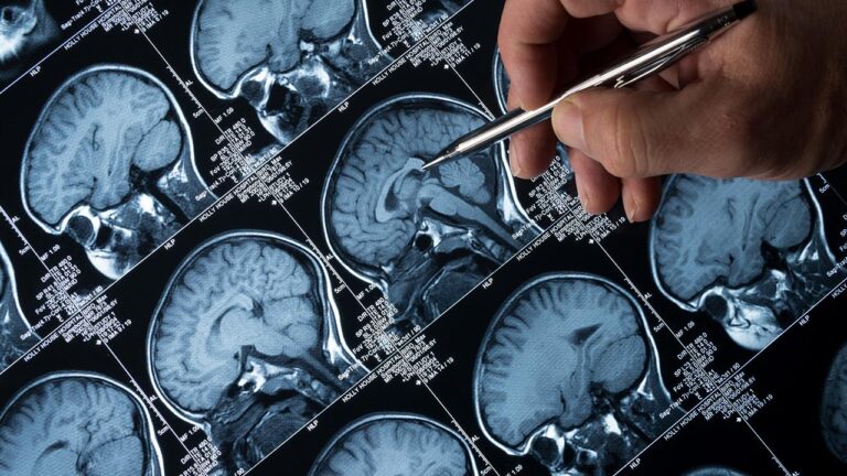 Ultrason Teknolojisi: Alzheimer ve Kanser İçin Yeni Bir Umut