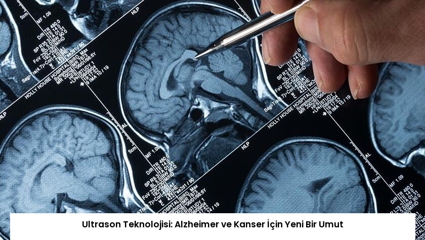Ultrason Teknolojisi: Alzheimer ve Kanser İçin Yeni Bir Umut