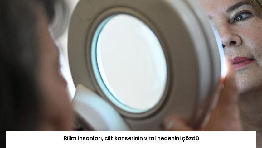 Bilim insanları, cilt kanserinin viral nedenini çözdü