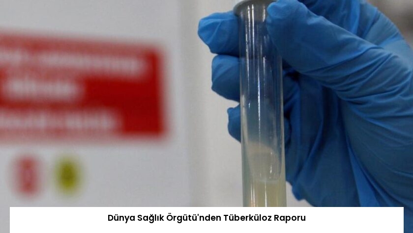 Dünya Sağlık Örgütü’nden Tüberküloz Raporu
