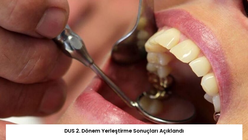 DUS 2. Dönem Yerleştirme Sonuçları Açıklandı
