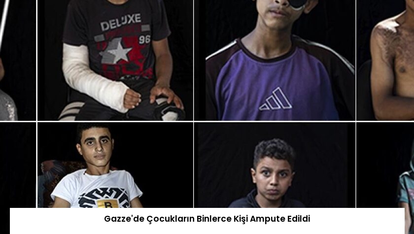 Gazze’de Çocukların Binlerce Kişi Ampute Edildi