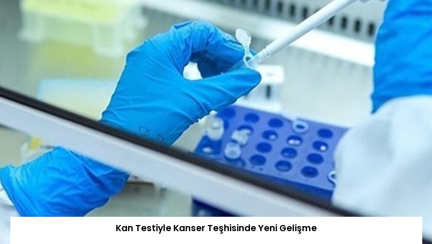 Kan Testiyle Kanser Teşhisinde Yeni Gelişme