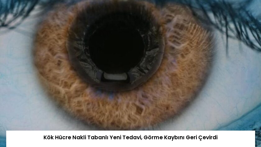 Kök Hücre Nakli Tabanlı Yeni Tedavi, Görme Kaybını Geri Çevirdi