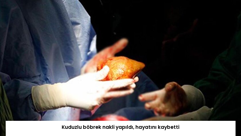 Kuduzlu böbrek nakli yapıldı, hayatını kaybetti