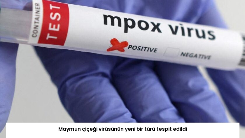 Maymun çiçeği virüsünün yeni bir türü tespit edildi