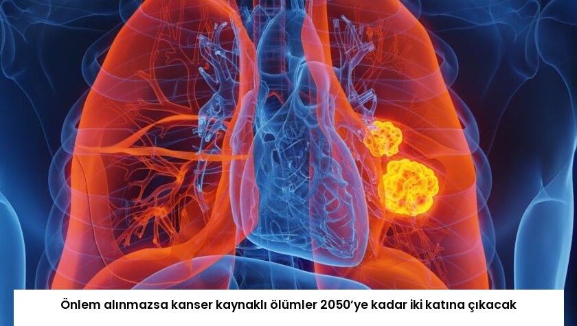 Önlem alınmazsa kanser kaynaklı ölümler 2050’ye kadar iki katına çıkacak