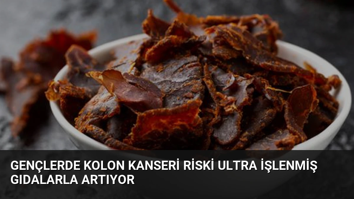 Gençlerde Kolon Kanseri Riski Ultra İşlenmiş Gıdalarla Artıyor