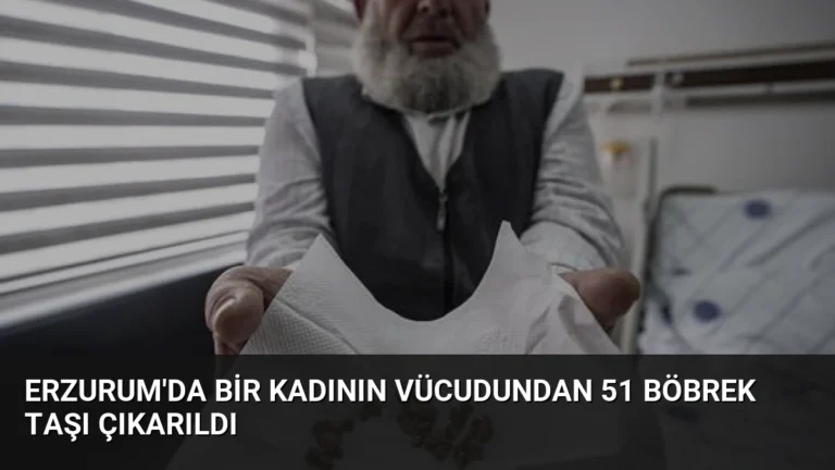 Erzurum’da Bir Kadının Vücudundan 51 Böbrek Taşı Çıkarıldı