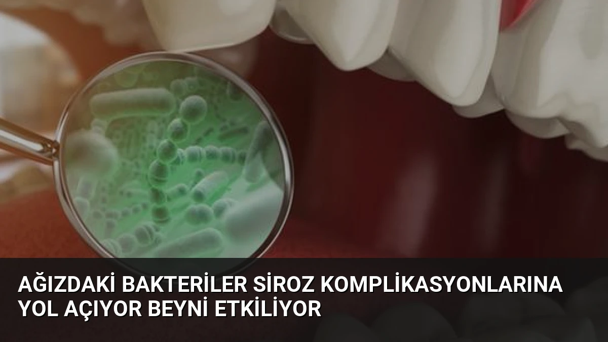 Ağızdaki Bakteriler Siroz Komplikasyonlarına Yol Açıyor Beyni Etkiliyor