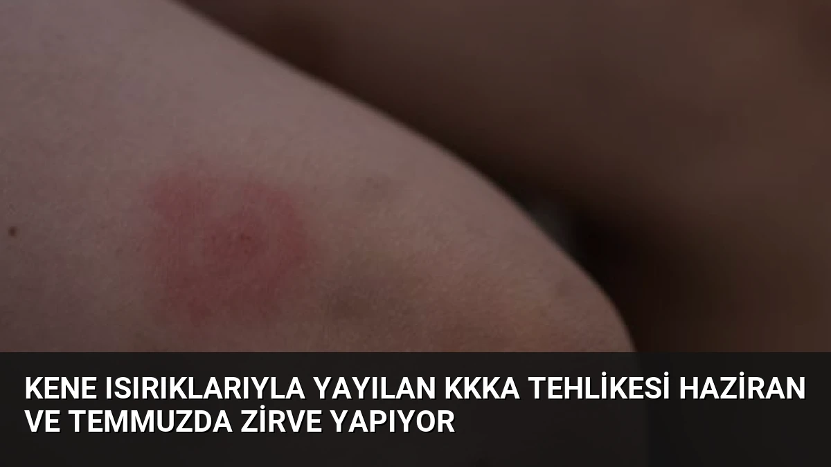 Kene Isırıklarıyla Yayılan KKKA Tehlikesi Haziran ve Temmuzda Zirve Yapıyor