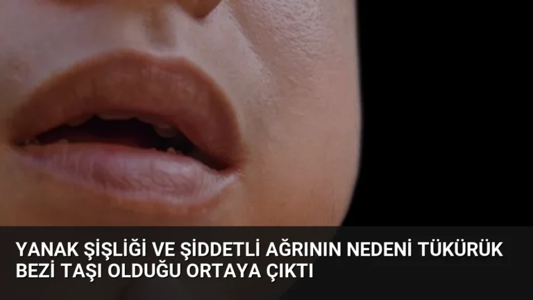 Yanak Şişliği ve Şiddetli Ağrının Nedeni Tükürük Bezi Taşı Olduğu Ortaya Çıktı